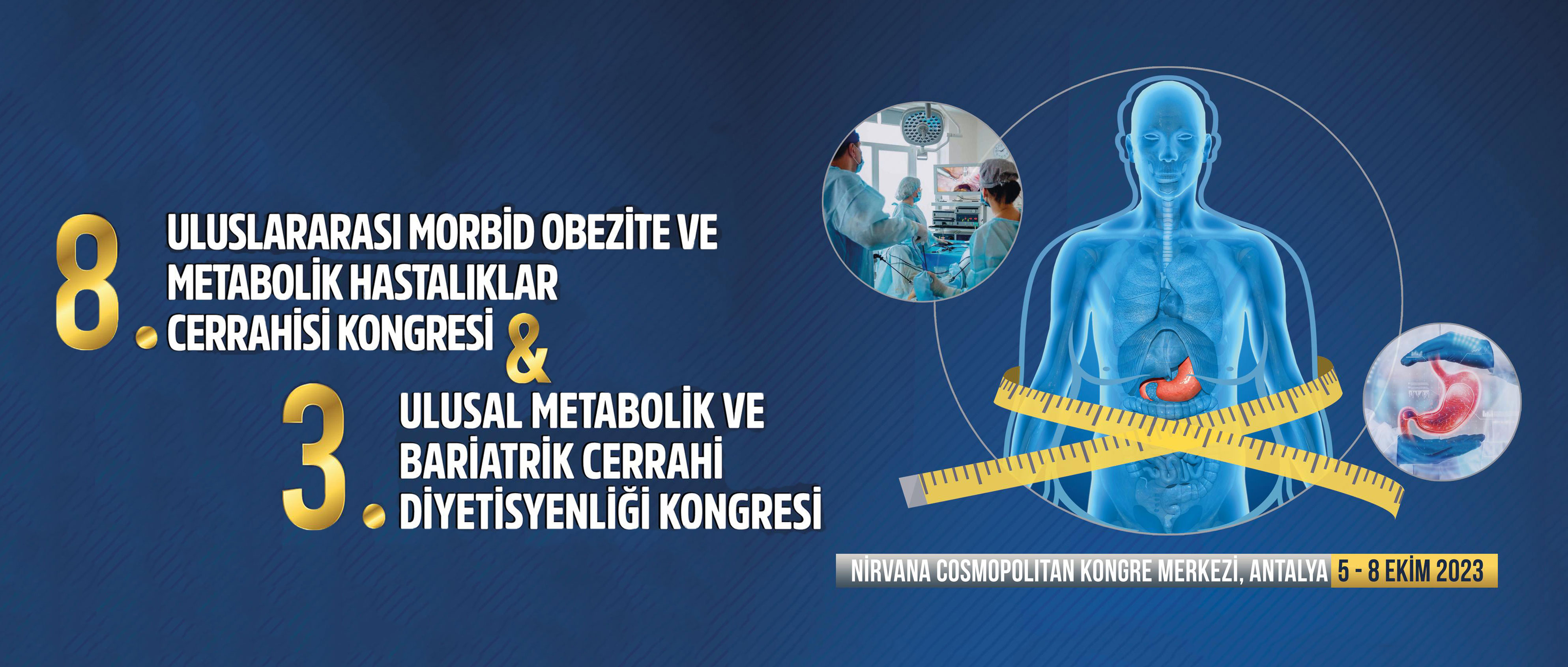 Qianjing Medical made a wonderful appearance at the International Congress of Morbid Obesity and Metabolic Disease Surgery in Turkey
